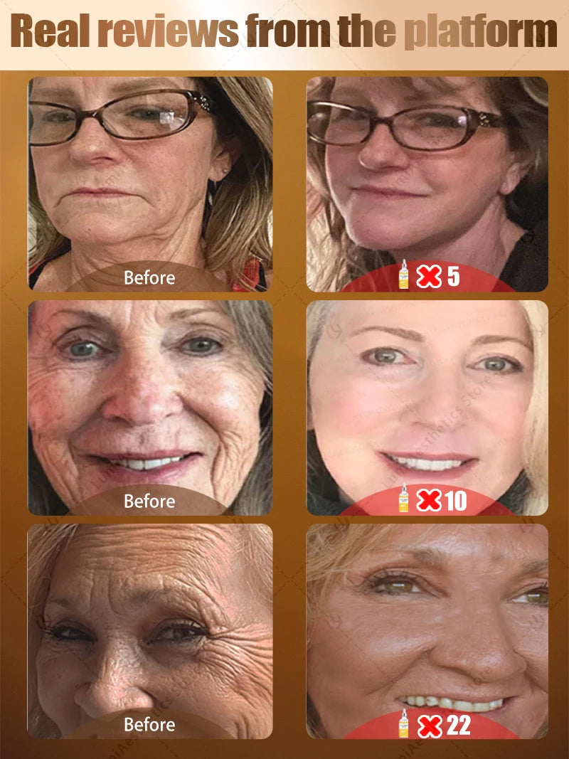 instant wrinkle free ageless