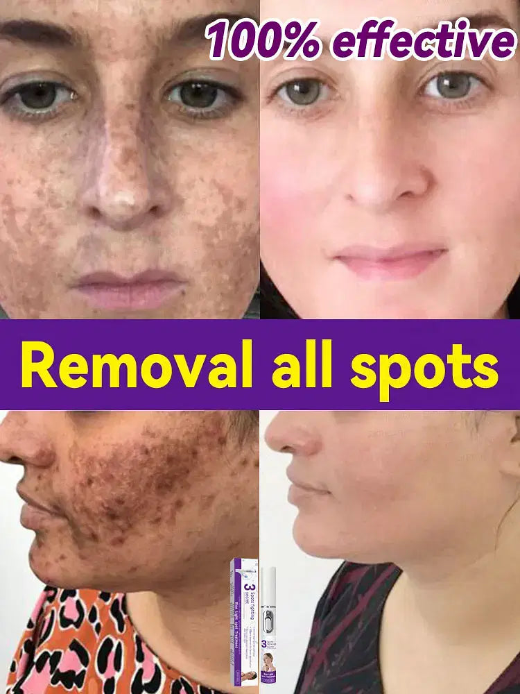 Color: WHITE - H? s? ???? ? s? ?? ??? s???, ?&ldquo