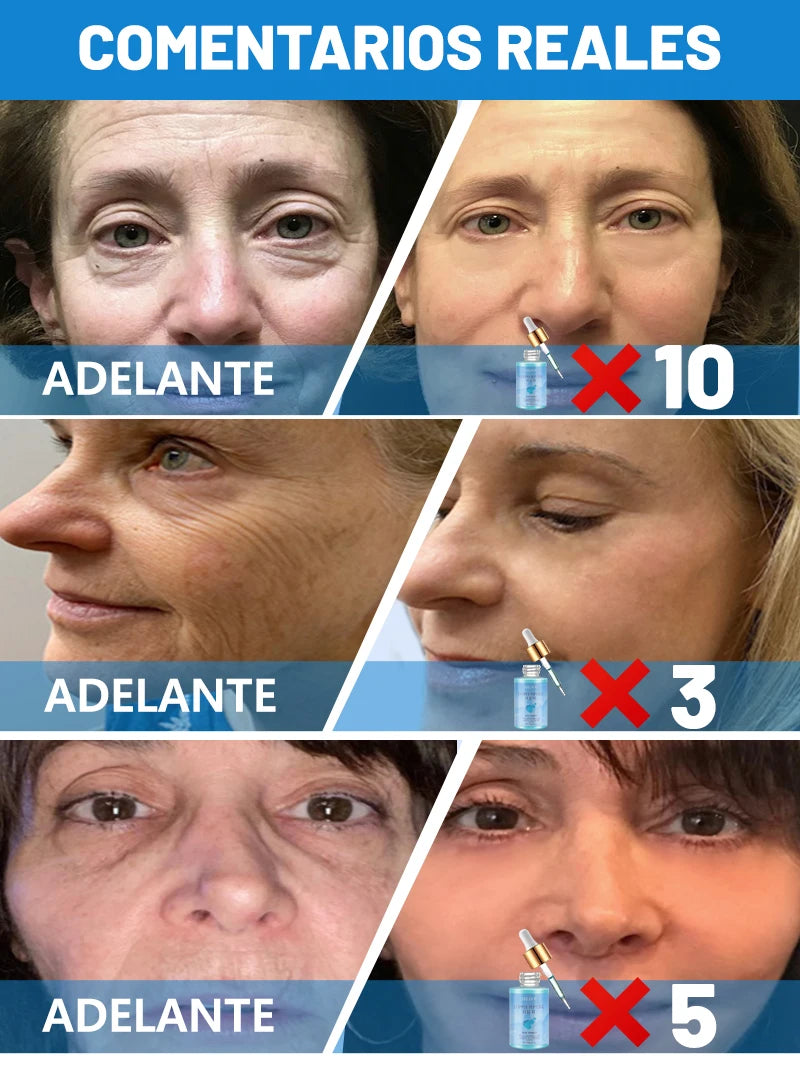 instant wrinkle free ageless