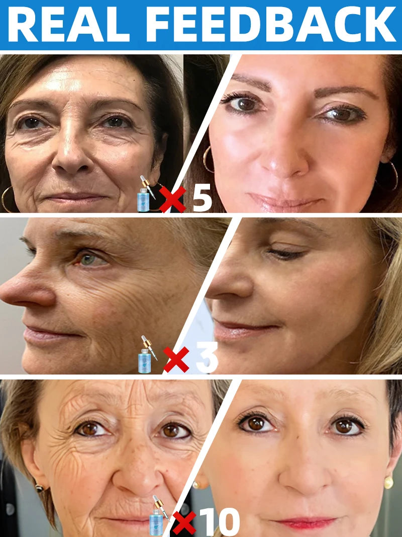 instant wrinkle free ageless