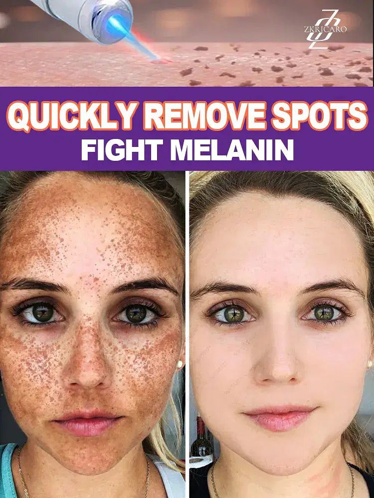 Color: WHITE - H? s? ???? ? s? ?? ??? s???, ?&ldquo