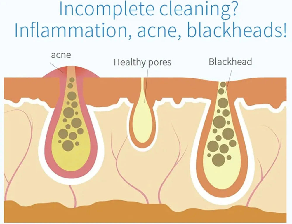 2IN1 Small BubbleVacuum Acne Pore Cleaner Blackhead Remover Skin Deep Cleaning Beauty Care Tools Moisturizing Beauty Instrument