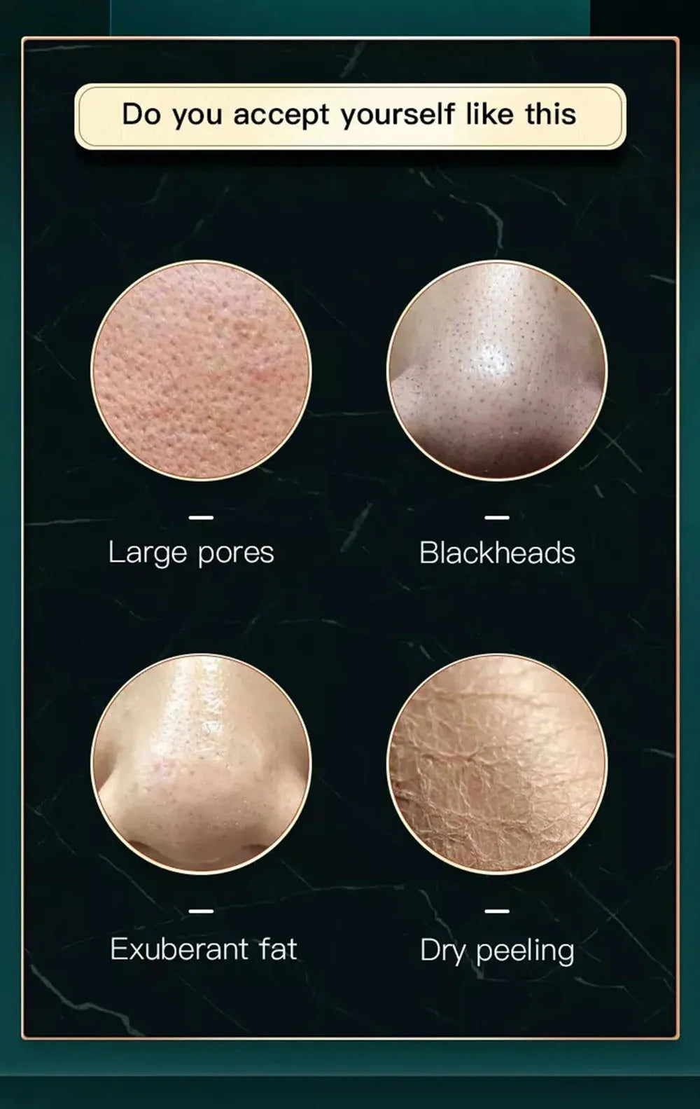 2IN1 Small BubbleVacuum Acne Pore Cleaner Blackhead Remover Skin Deep Cleaning Beauty Care Tools Moisturizing Beauty Instrument