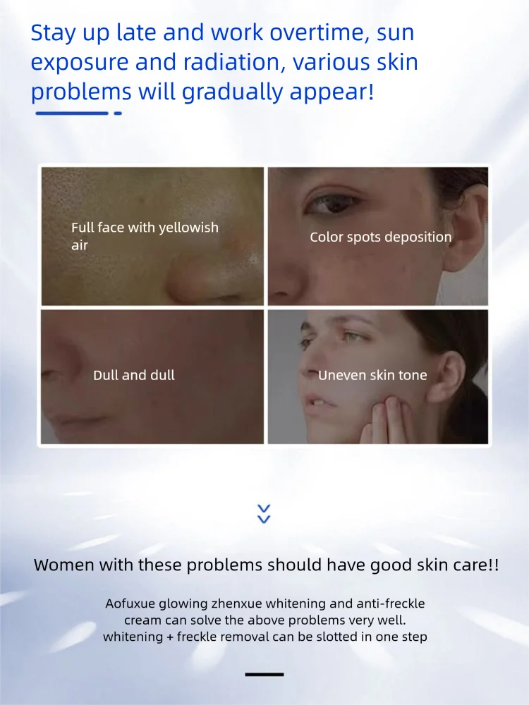 Whitening Freckles Cream Remove Melasma Dark Spots Corrector Lighten Melanin Pigmentation Brightening Skin