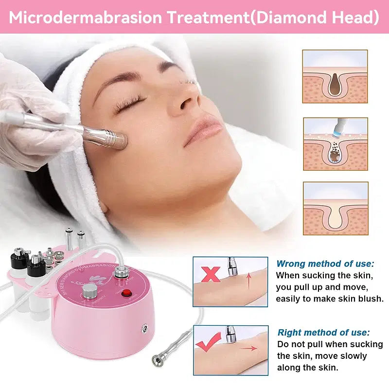 Color: White, Ships From: CHINA - 3 in 1 Diamond Microdermabrasion Dermabrasion Machine For Facial Blackhead Removal Acne Wrinkle Skin Care Device